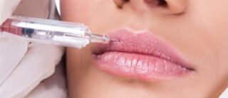 Липофилинг губ: безопасно, сексуально, надолго
