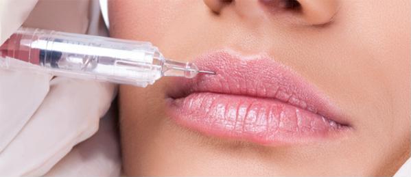 Липофилинг губ: безопасно, сексуально, надолго