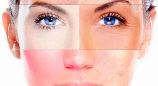 Здоровая кожа осенью