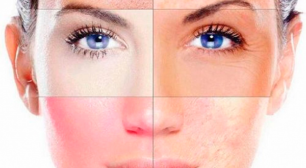 Здоровая кожа осенью