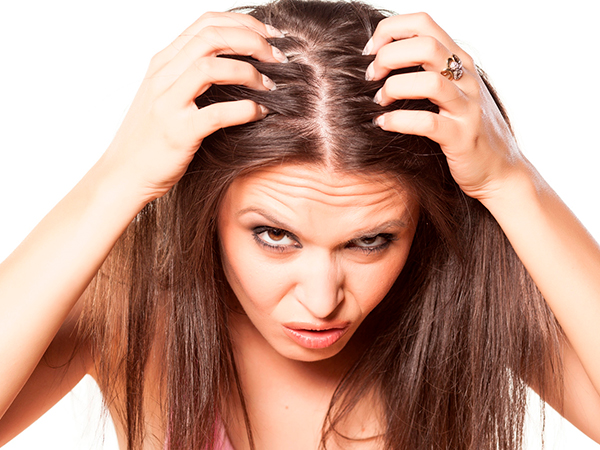 Как выявить перхоть?