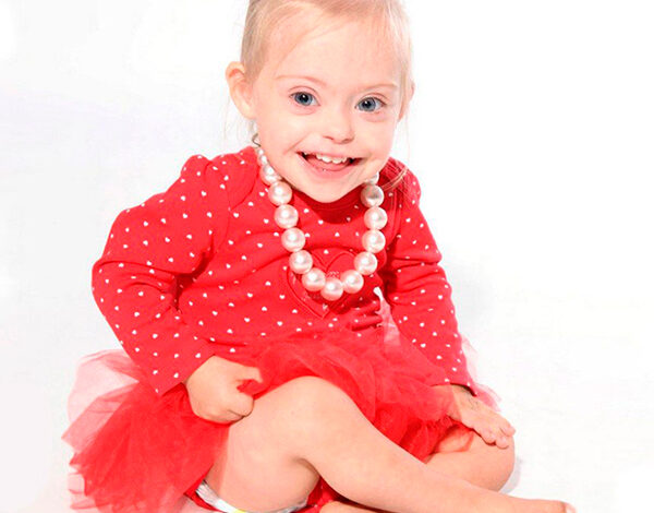 Двухлетняя фотомодель с синдромом Дауна не оставляет равнодушной!