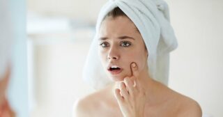 Проблемная кожа. 10 советов, которые работают.